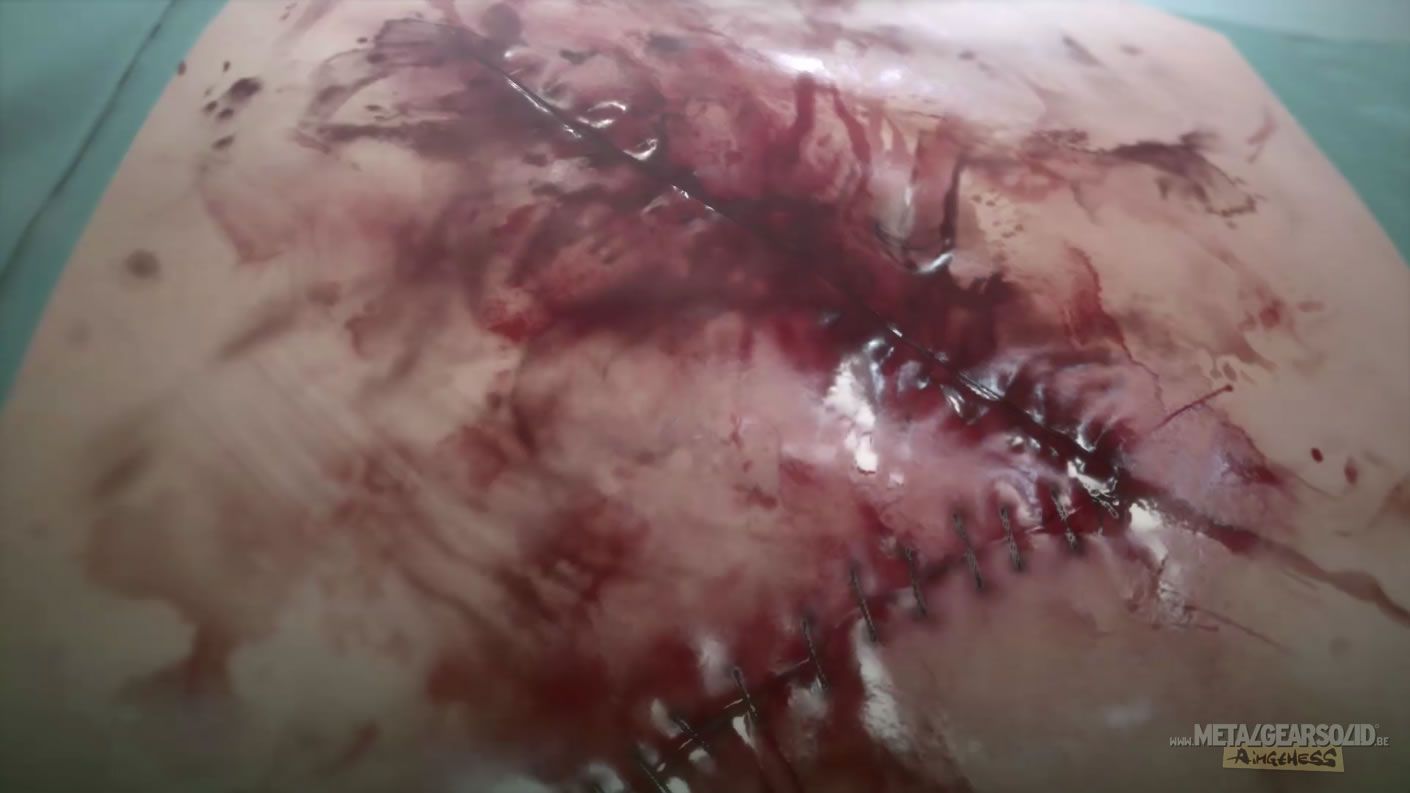 E3 2015 : Notre galerie d'images des trailers de Metal Gear Solid V : The Phantom Pain