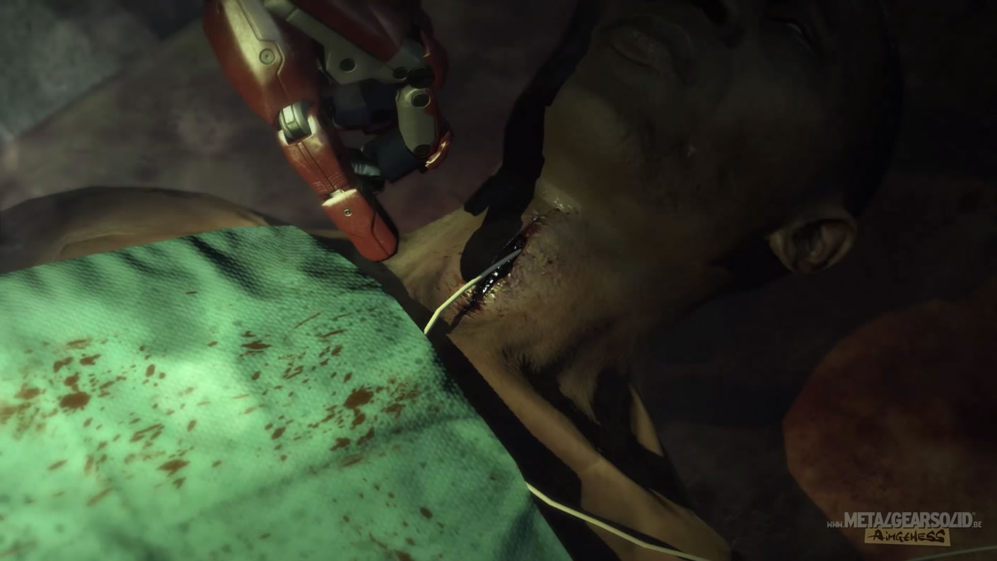 E3 2015 : Notre galerie d'images des trailers de Metal Gear Solid V : The Phantom Pain