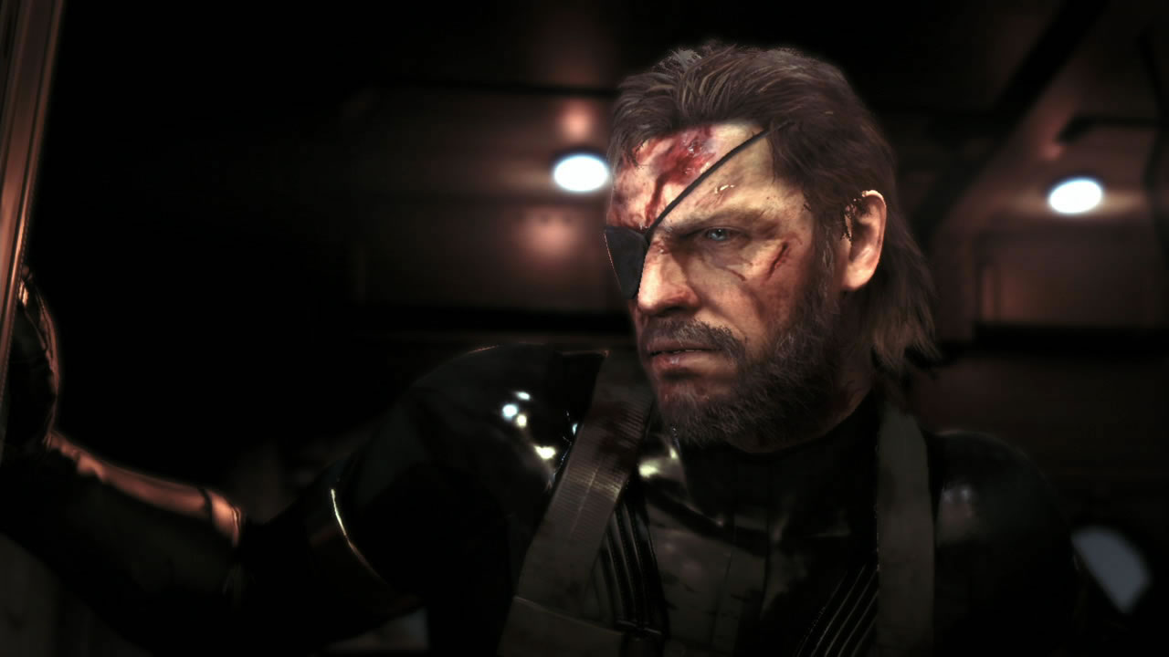 Metal Gear Solid V : Le thermomtre  Zeroes